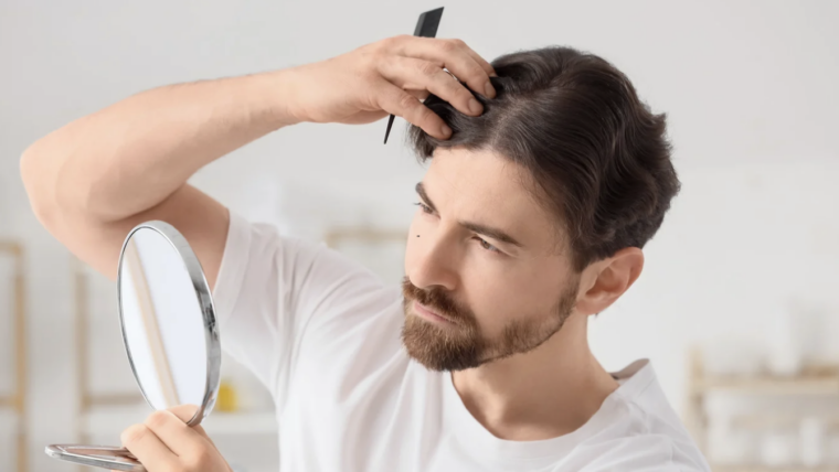 Hair Loss Consultationation and Treatment Near Dundalk, Maryland